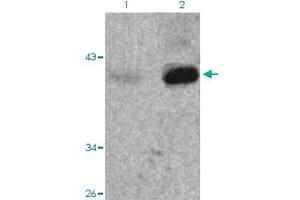 Western blot analysis of Lane 1: 293 cells, Lane 2: TNF treated 293 cells with Nfkbie (phospho S22) polyclonal antibody  at 1:500-1:1000 dilution. (NFKBIE Antikörper  (pSer22))