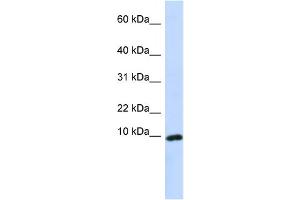 WB Suggested Anti-CXCL9 Antibody Titration:  0. (CXCL9 Antikörper  (Middle Region))