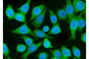 IF analysis of PI 3 Kinase p85 alpha/PIK3R1 using anti-PI 3 Kinase p85 alpha/PIK3R1 antibody (ABIN7599781). (PIK3R1 Antikörper  (AA 117-153))