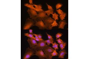 Immunofluorescence (IF) image for anti-Adenosine Kinase (ADK) (AA 200-345) antibody (ABIN7265462)