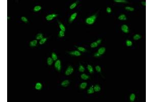 Immunofluorescence staining of Hela cells with ABIN7139615 at 1:2. (H2AFX Antikörper  (pSer139))