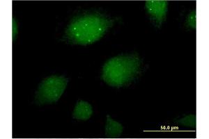 Immunofluorescence of monoclonal antibody to ING2 on HeLa cell. (ING2 Antikörper  (AA 1-280))