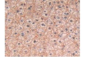 Detection of IL4 in Human Liver Tissue using Polyclonal Antibody to Interleukin 4 (IL4)