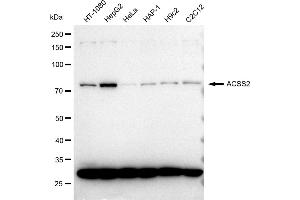 Western blotting analysis using ACSS2 antibody (ABIN7797499).