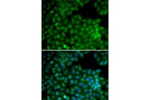 Immunofluorescence analysis of U20S cell using CDK7 antibody. (CDK7 Antikörper  (AA 1-346))