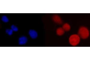 IF analysis of PCBP2/hnRNP E2 using anti-PCBP2/hnRNP E2 antibody (ABIN7600448). (PCBP2 Antikörper  (AA 197-276))