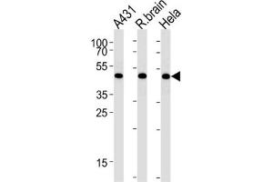 Western Blotting (WB) image for anti-DEAD (Asp-Glu-Ala-Asp) Box Polypeptide 39 (DDX39) antibody (ABIN3003892)