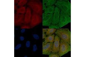 ABIN6259023 and ABIN6273879 staining Hela cells(30 min of UV treatment) by IF/ICC. (LGR4 Antikörper  (C-Term))