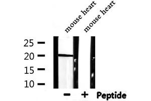 Western blot analysis of extracts from mouse heart, using ARF1 Antibody. (ARF1 Antikörper  (Internal Region))