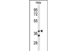 Western blot analysis of CYTH3 Antibody in Hela cell line lysates (35ug/lane). (Cytohesin 3 Antikörper  (C-Term))
