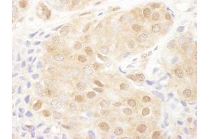 Immunohistochemistry (IHC) image for anti-Proteasome (Prosome, Macropain) 26S Subunit, Non-ATPase, 2 (PSMD2) (AA 50-100) antibody (ABIN7454976)