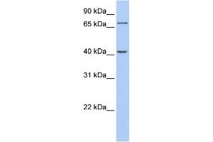 WB Suggested Anti-GALNT4 Antibody Titration:  0.
