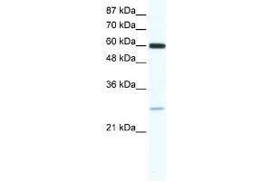 WB Suggested Anti-ZFP91 Antibody   Titration: 0. (ZFP91 Antikörper  (N-Term))