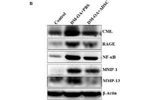 Western Blotting (WB) image for anti-Matrix Metallopeptidase 1 (Interstitial Collagenase) (MMP1) antibody (ABIN2854783)