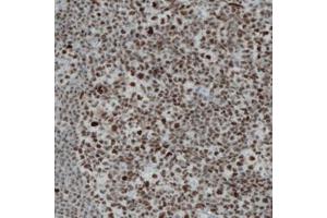 Immunohistochemical staining (Formalin-fixed paraffin-embedded sections) of human tonsil with REST monoclonal antibody, clone CL0381  shows strong nuclear immunoreactivity in the lymphoid cells. (REST Antikörper)