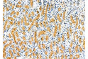 ABIN6263023 and ABIN6277536 at 1/100 staining Rat kidney tissue by IHC-P.