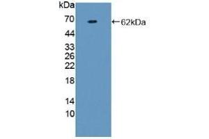 Prothrombin Fragment 1+2 Antikörper