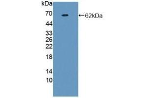 Detection of Recombinant F1+2, Human using Polyclonal Antibody to Prothrombin Fragment 1+2 (F1+2) (Prothrombin Fragment 1+2 Antikörper)