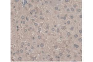 DAB staining on IHC-P; Samples:Mouse Liver Tissue
