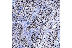 IHC analysis of SF3B3 using anti-SF3B3 antibody (ABIN7602378).