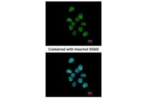 ICC/IF Image Immunofluorescence analysis of paraformaldehyde-fixed A431, using PUF60, antibody at 1:500 dilution.