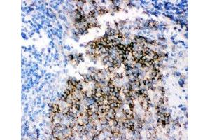 IHC-P staining of rat spleen tissue (CD79b Antikörper  (AA 29-229))