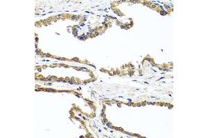 Immunohistochemistry of paraffin-embedded human prostate using OGFR antibody at dilution of 1:100 (x40 lens). (OGFR Antikörper)