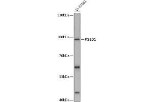Western blot analysis of extracts of U-87MG cells, using PGBD1 antibody (ABIN7269372) at 1:1000 dilution. (PGBD1 Antikörper  (AA 150-450))