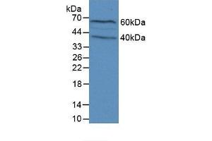 Detection of FLG in Mouse Brain Tissue using Polyclonal Antibody to Filaggrin (FLG) (Filaggrin Antikörper  (AA 119-336))