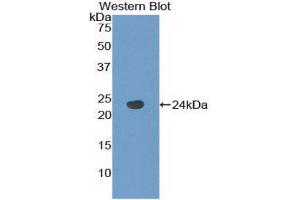 Western Blotting (WB) image for anti-Tachykinin Receptor 2 (TACR2) (AA 92-290) antibody (ABIN1860673) (TACR2 Antikörper  (AA 92-290))