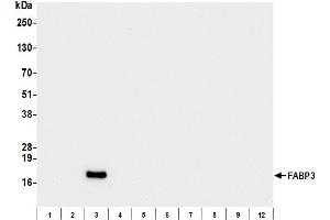 Western Blotting (WB) image for anti-Fatty Acid Binding Protein 3, Muscle and Heart (FABP3) antibody (ABIN7795612)