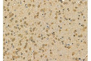 BTF3L3 Antibody at 1/100 staining rat brain tissue by IHC-P. (BTF3P13 Antikörper)