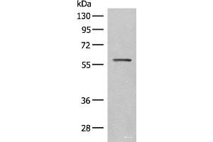 Western blot analysis of Mouse eye tissue lysate using SLC5A1 Polyclonal Antibody at dilution of 1:500 (SLC5A1 Antikörper)