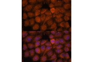 Immunofluorescence analysis of HeLa cells using NDUF antibody (ABIN7268807) at dilution of 1:100.