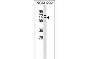 ZN Antibody (N-term) (ABIN1539295 and ABIN2849920) western blot analysis in NCI- cell line lysates (35 μg/lane). (ZNF599 Antikörper  (N-Term))