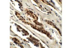 Immunohistochemical staining of human kidney cells with GLS2 polyclonal antibody  at 5 ug/mL.