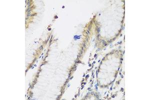 Immunohistochemistry of paraffin-embedded human stomach using NAA50 antibody at dilution of 1:200 (40x lens). (NAA50 Antikörper)