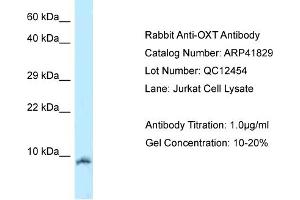 Host:  Rabbit  Target Name:  OXT  Sample Tissue:  Human Jurkat  Antibody Dilution:  1ug/ml (OXT Antikörper  (N-Term))
