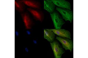 ABIN6257285 and ABIN6273674 staining  cells by IF/ICC.
