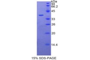 SDS-PAGE (SDS) image for Bactericidal/Permeability Increasing Protein (BPI) (AA 140-250) protein (His tag,GST tag) (ABIN1877636) (BPI Protein (AA 140-250) (His tag,GST tag))