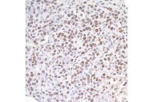 Immunohistochemistry (IHC) image for anti-Achaete-Scute Complex Homolog 2 (ASCL2) (AA 225-275) antibody (ABIN7454590) (ASCL2 Antikörper  (AA 225-275))