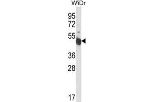 Western Blotting (WB) image for anti-Inscuteable Homolog (INSC) antibody (ABIN3004284) (INSC Antikörper)