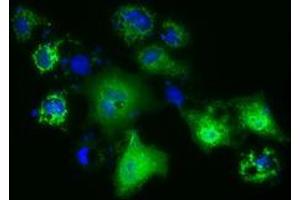 Anti-PANK2 mouse monoclonal antibody (ABIN2453419) immunofluorescent staining of COS7 cells transiently transfected by pCMV6-ENTRY PANK2 (RC215676). (PANK2 Antikörper)