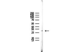 anti-Catechol-O-Methyltransferase (COMT) (N-Term) antibody