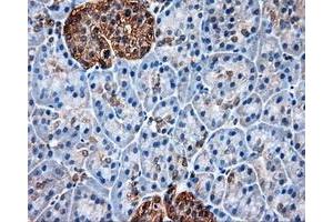 Immunohistochemical staining of paraffin-embedded liver tissue using anti-HSP90AA1mouse monoclonal antibody. (HSP90AA1 Antikörper)