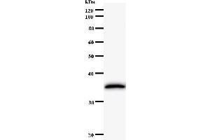 Western Blotting (WB) image for anti-Excision Repair Cross-Complementing Rodent Repair Deficiency, Complementation Group 8 (ERCC8) antibody (ABIN931164) (ERCC8 Antikörper)
