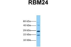 Host:  Rabbit  Target Name:  RBM24  Sample Tissue:  Human MCF7  Antibody Dilution:  1. (RBM24 Antikörper  (Middle Region))