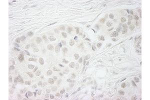 Immunohistochemistry (IHC) image for anti-Budding Uninhibited By Benzimidazoles 1 Homolog beta (Yeast) (BUB1B) (AA 1-50) antibody (ABIN7448450) (BUB1B Antikörper  (AA 1-50))