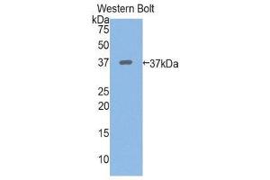 Western Blotting (WB) image for anti-Periplakin (PPL) (AA 1439-1716) antibody (ABIN1860294) (PPL Antikörper  (AA 1439-1716))