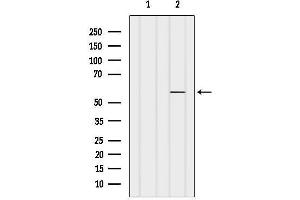 anti-PDZ and LIM Domain 7 (Enigma) (PDLIM7) (N-Term) antibody